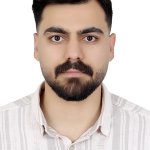 مصطفی شیبانی لنز اسکلرال| قوز قرنیه| تنبلی چشم