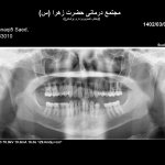 دکتر پریسا شانقی دکترای حرفه ای دندانپزشکی