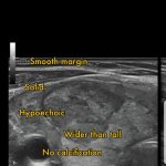 دکتر نغمه ابراهیمی متخصص رادیولوژی فلوشیپ بیماری های پستان