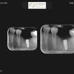 دکتر یاسمن آل یاسین جراحی لثه, متخصص جراحی لثه و ایمپلنت