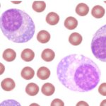 الناز خیابانی بیماری های داخلی ، خون و انکولوژی