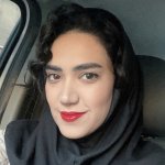 مریم زارع توتستانی رزیدنت ارشد گوش و حلق و بینی دانشگاه علوم پزشکی تهران بیمارستان امیراعلم و امام خمینی