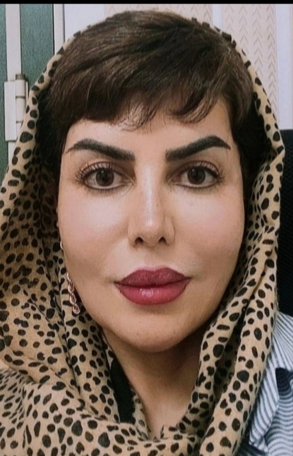 لیلا قاسمی مامایی زنان/ معاینه بکارت هایمن و گواهی سلامت /زگیل و تب خال تناسلی /عفونت واژن و زخم دهانه رحم زنان/تست hpvزگیل و پاپ اسمیر/مشاوره مصرف قرص و روش های اورژانسی و جلوگیری،عفونت ادراری ،سوزش خارش ،کیست و تنبلی تخمدان ،خونریزی ه